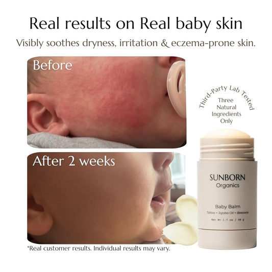Baby Balm | 3 Natural Ingredient Moisturizing Stick for Eczema Relief, Sensitive Skin & Diaper Rash | Grass-Fed Tallow, Organic Jojoba & Beeswax | Lab Tested Baby-Safe, Made in USA