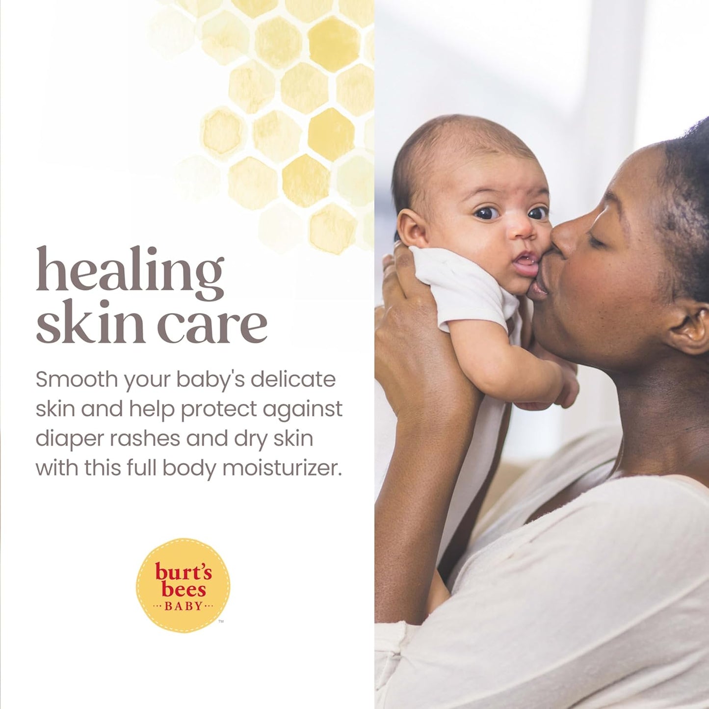 Burt's Bees Baby Diaper Rash Ointment, Maximum Strength, 40% Zinc Oxide, 100% Natural Origin, Pediatrician Tested, Net Weight 3 Ounces , Pack of 2
