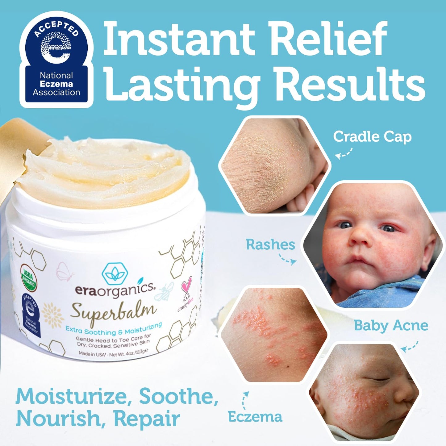 Era Organics Healing Ointment for Babies - USDA Certified Organic Natural Moisturizer Gentle on Sensitive Skin Prone To Baby Eczema, Cradle Cap (Infant Seborrheic Dermatitis), Rashes, Hives and More
