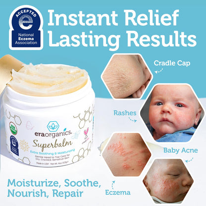 Era Organics Healing Ointment for Babies - USDA Certified Organic Natural Moisturizer Gentle on Sensitive Skin Prone To Baby Eczema, Cradle Cap (Infant Seborrheic Dermatitis), Rashes, Hives and More