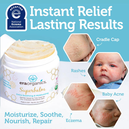 Era Organics Healing Ointment for Babies - USDA Certified Organic Natural Moisturizer Gentle on Sensitive Skin Prone To Baby Eczema, Cradle Cap (Infant Seborrheic Dermatitis), Rashes, Hives and More