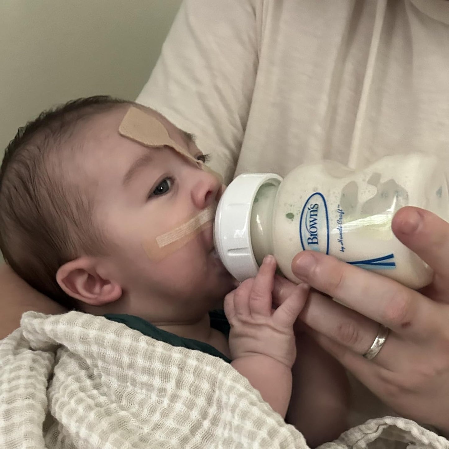 Dr. Brown's Medical Specialty Feeding System Wide-Neck Baby Bottles, Oral Feeding Solution for Preemies and Infants with Cleft Lip & Feeding Challenges, 5 oz/150 mL, 0m+ – 3-Pack