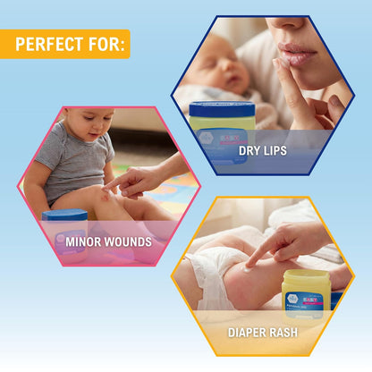 MED PRIDE Petroleum Jelly with Fresh Baby Scent, Pink, 8 oz – Skin Protectant & Moisturizing Ointment for Dry Skin, Rashes, Minor Burns, Chapped Lips & Diaper Rash