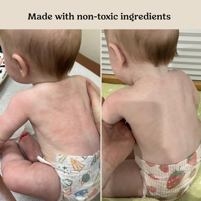 Roe Wellness- Baby Cream Lotion Ointment EWG Verified Non-Toxic Ingredients | Full Body Biome Barrier | Dry Skin, Itch Relief, Moisturizing, All Over Ointment | Toddlers & Kids