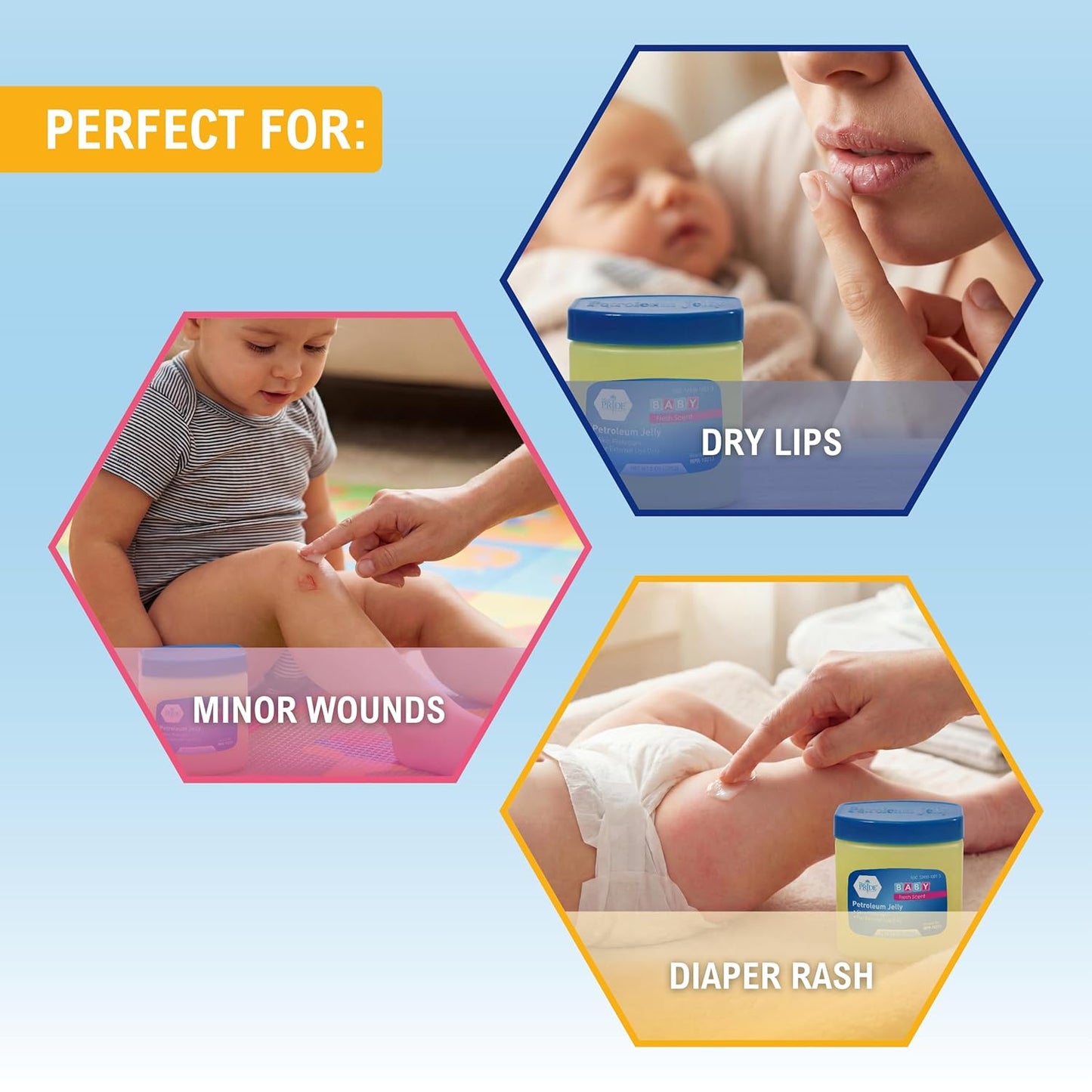 MED PRIDE Petroleum Jelly with Fresh Baby Scent, Pink, 8 oz – Skin Protectant & Moisturizing Ointment for Dry Skin, Rashes, Minor Burns, Chapped Lips & Diaper Rash