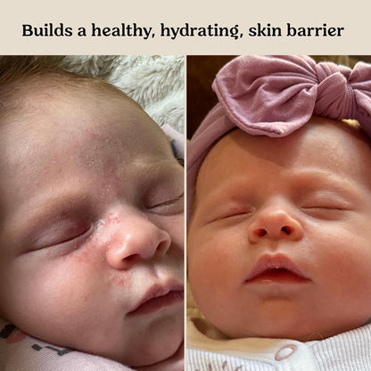 Roe Wellness- Baby Cream Lotion Ointment EWG Verified Non-Toxic Ingredients | Full Body Biome Barrier | Dry Skin, Itch Relief, Moisturizing, All Over Ointment | Toddlers & Kids