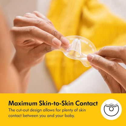 Medela Contact Nipple Shields for Breastfeeding