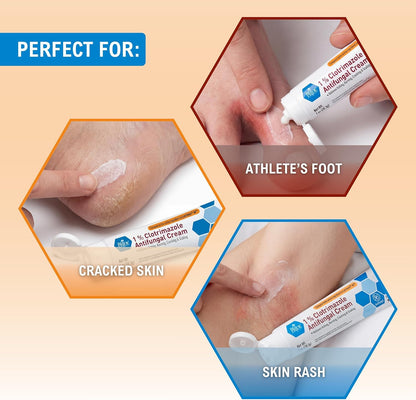 MED PRIDE 1% Clotrimazole Antifungal Cream 1oz- Fungus Skin Care Treatment with - Jock Itch Body Ointment - Fights Infection, Sweat Rash, Athletes Foot, Ringworm & Relieves Itching, Burning